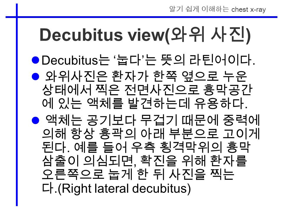 알기 쉽게 이해하는 chest x-ray Decubitus view( 와위 사진 ) Decubitus 는 ‘ 눕다 ’ 는 뜻의 라틴어이다.