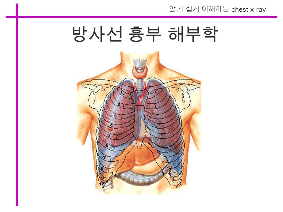 알기 쉽게 이해하는 chest x-ray 방사선 흉부 해부학