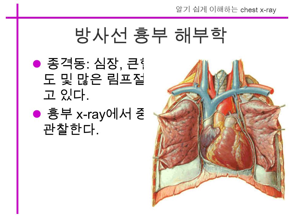 알기 쉽게 이해하는 chest x-ray 방사선 흉부 해부학 종격동 : 심장, 큰혈관, 기관, 기관지, 식 도 및 많은 림프절등의 구조물을 포함하 고 있다.
