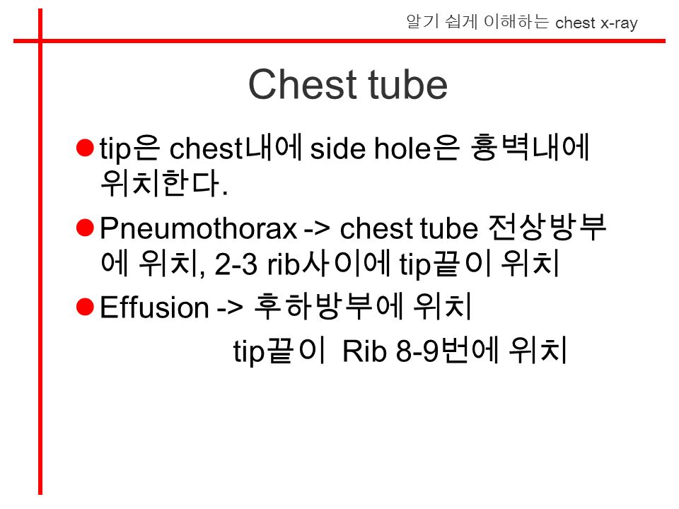알기 쉽게 이해하는 chest x-ray Chest tube tip 은 chest 내에 side hole 은 흉벽내에 위치한다.