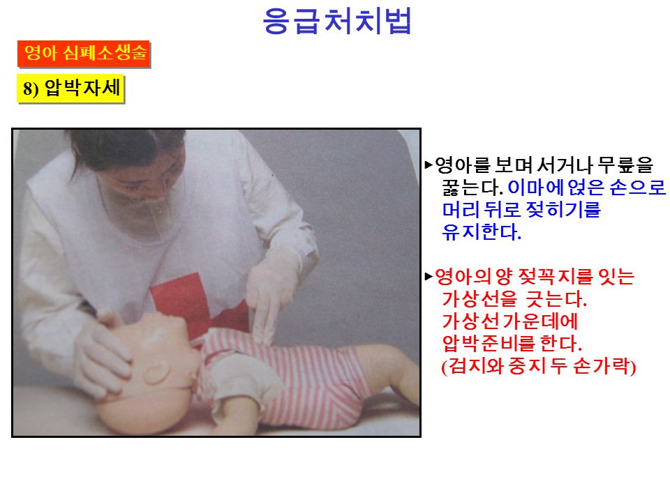 응급처치법 8) 압박자세 ▶영아를 보며 서거나 무릎을 꿇는다. 이마에 얹은 손으로 머리 뒤로 젖히기를 유지한다.