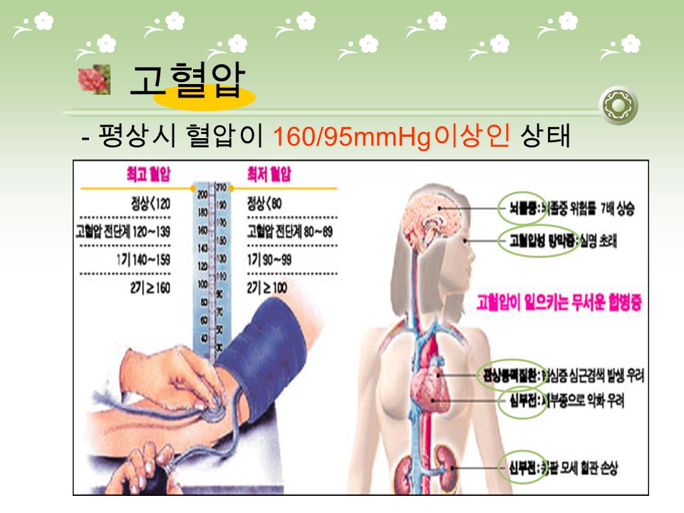 고혈압 - 평상시 혈압이 160/95mmHg 이상인 상태