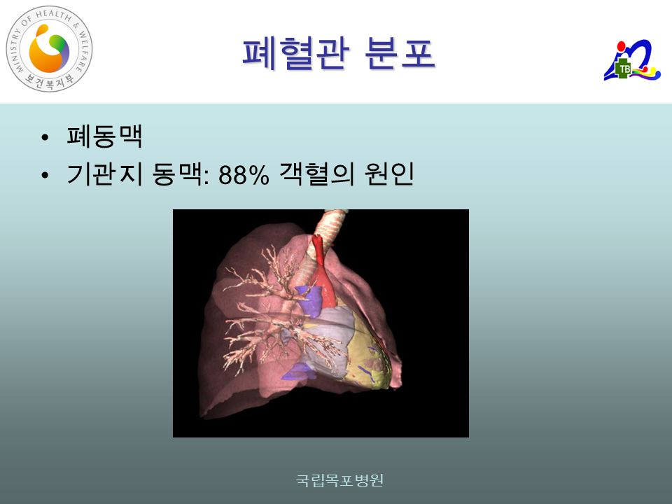 국립목포병원 폐혈관 분포 폐동맥 기관지 동맥 : 88% 객혈의 원인