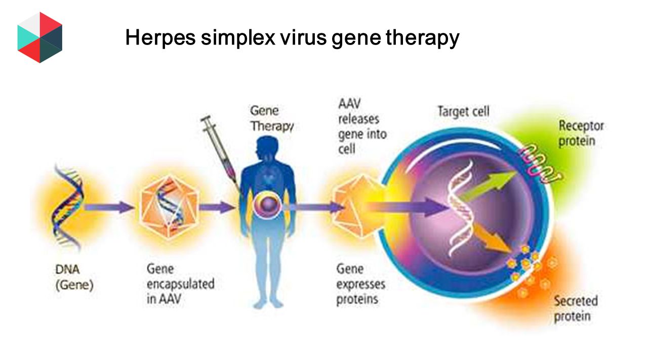 Herpes simplex virus gene therapy