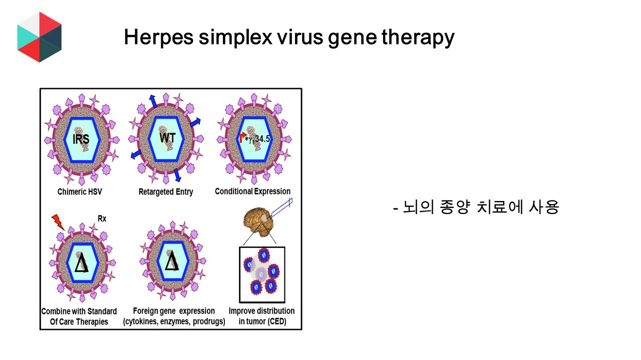 Herpes simplex virus gene therapy - 뇌의 종양 치료에 사용