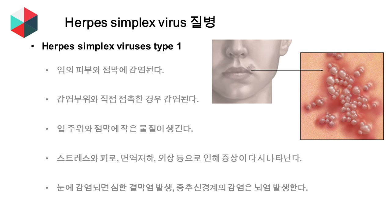 Herpes simplex viruses type 1 입의 피부와 점막에 감염된다. 감염부위와 직접 접촉한 경우 감염된다.