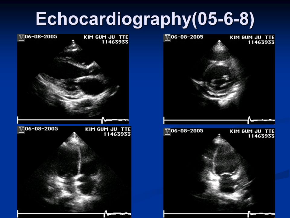 Echocardiography(05-6-8)