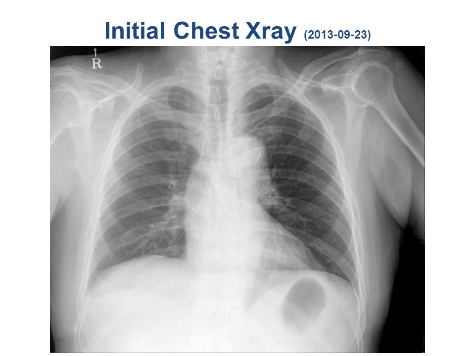 Initial Chest Xray ( )