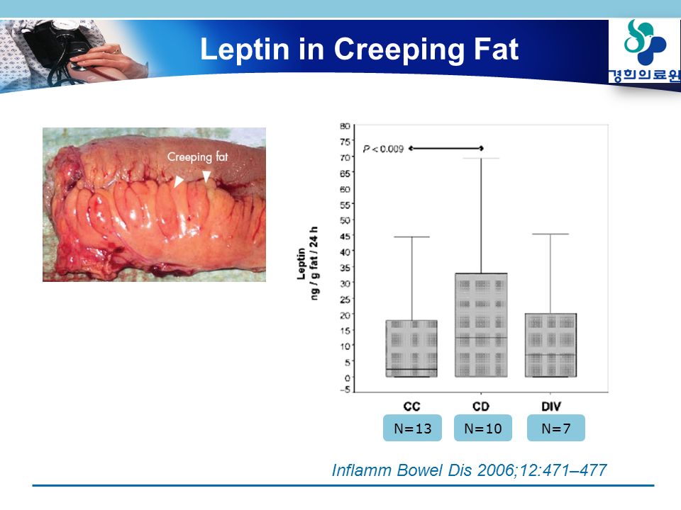 Leptin in Creeping Fat Inflamm Bowel Dis 2006;12:471–477 N=13N=10N=7