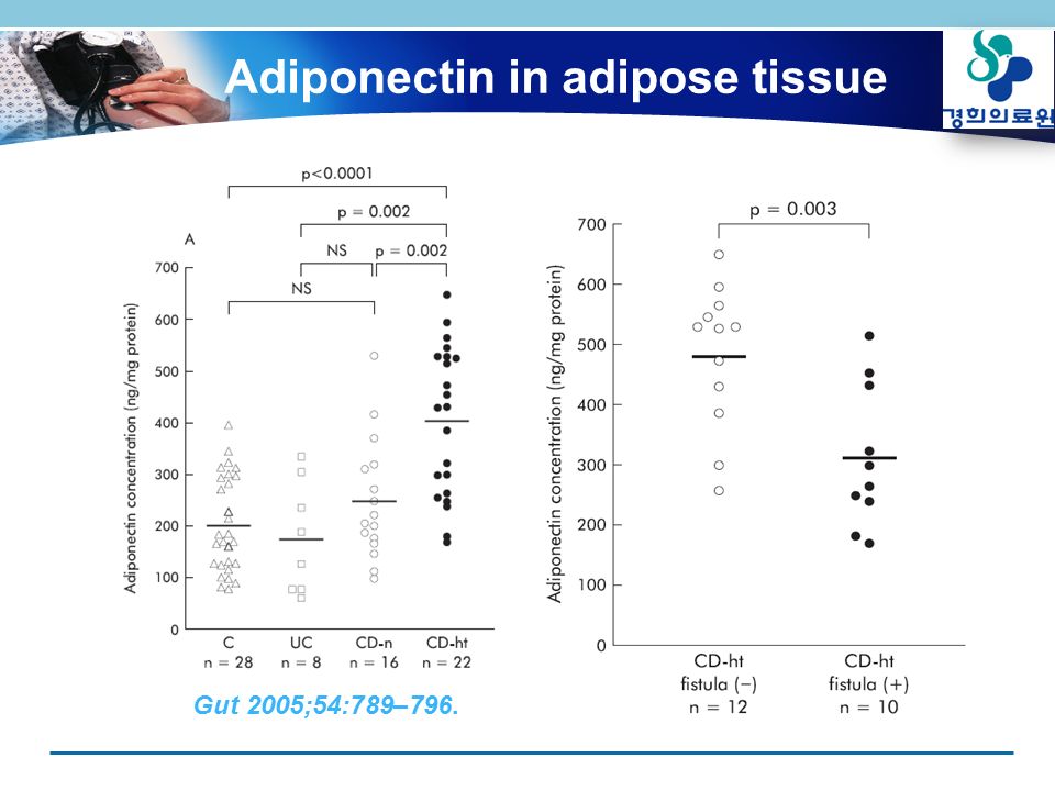 Adiponectin in adipose tissue Gut 2005;54:789–796.Inflamm Bowel Dis 2006