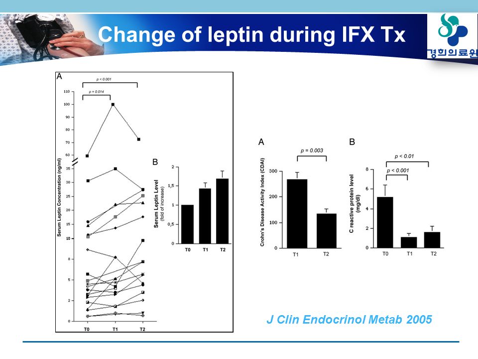 Change of leptin during IFX Tx J Clin Endocrinol Metab 2005