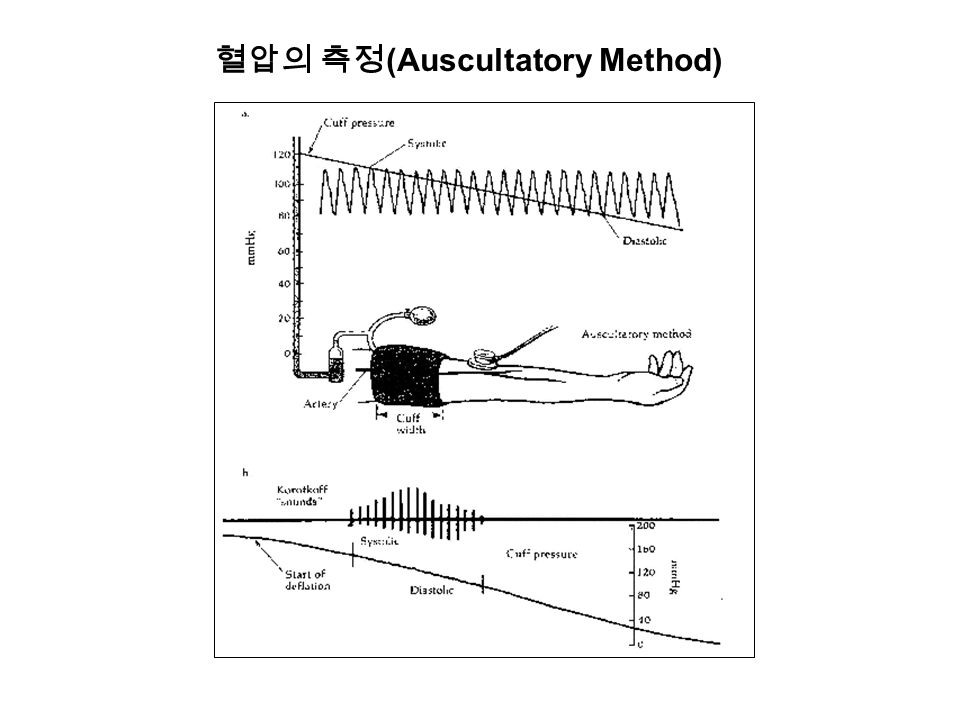 혈압의 측정 (Auscultatory Method)